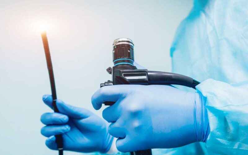 O que é a gastroplastia endoscópica